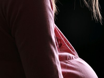 abortusz Getty Images